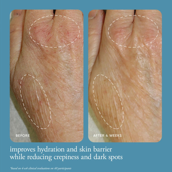 philosophy-in-good-hands-multi-restorative-hand-cream-before-and-after