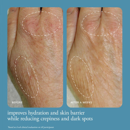 philosophy-in-good-hands-multi-restorative-hand-cream-before-and-after